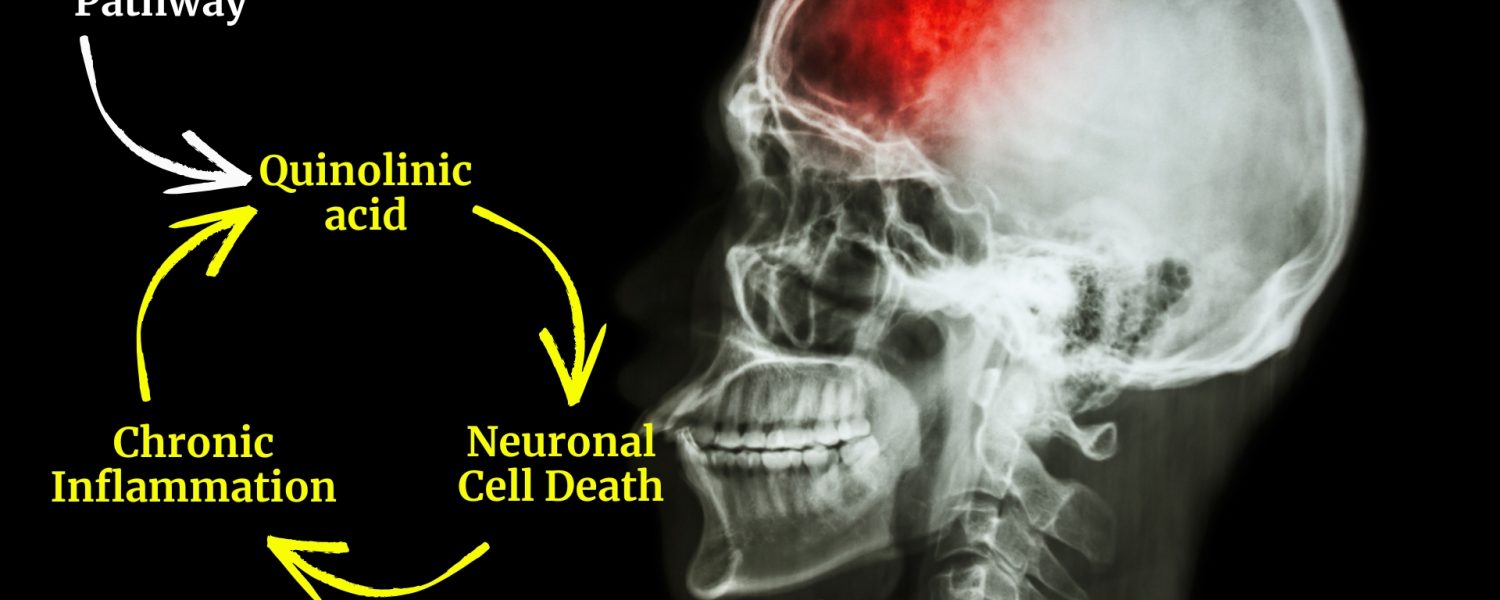 ID: Image of a skull with red coloring to highlight neuroinflammation while the left side displays how the kynurenine pathway damages the brain.